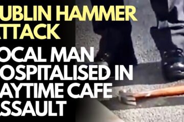 DUBLIN Hammer Attack- Man seriously injured in ‘EVERYONE WELCOME’ area