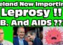 Ireland is now importing ” LEPROSY ” T.B ” And ” AIDS ” ????? This is NOT Progress !